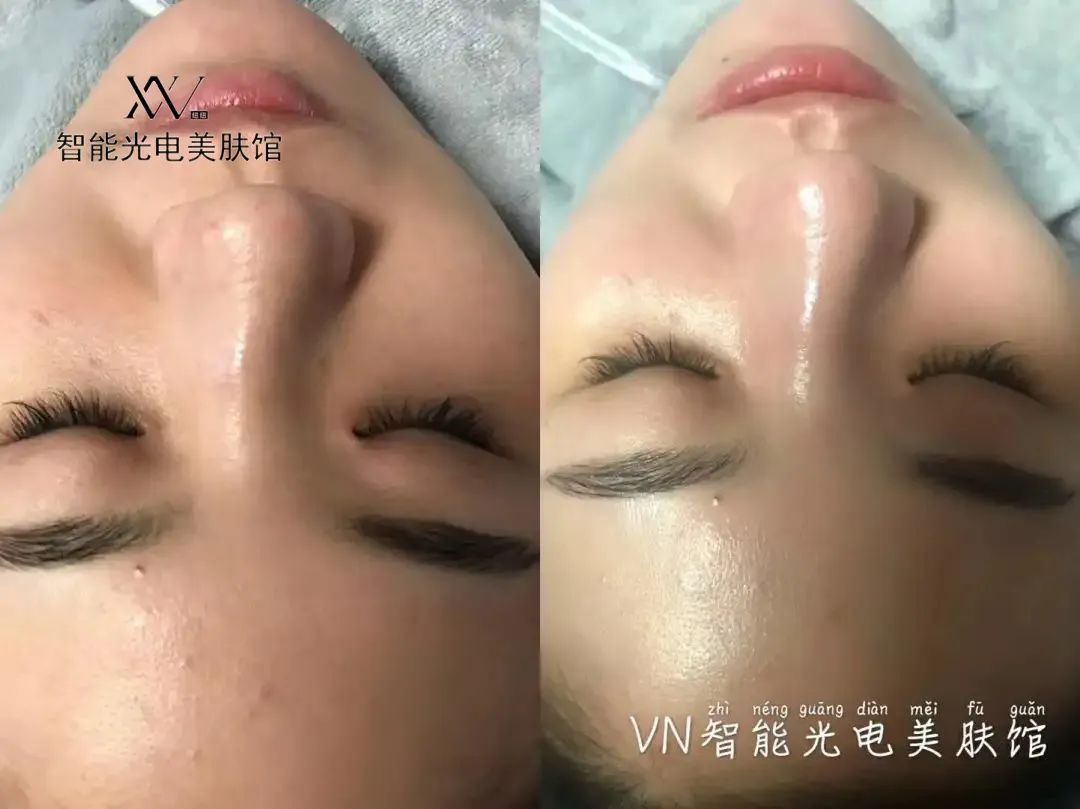 VN美業(yè)運(yùn)營(yíng)：掌握這5種需求，顧客追著你買單！